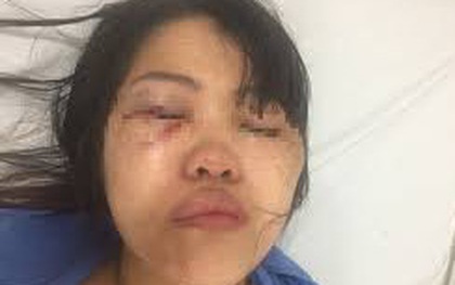 Vụ nữ nhân viên điều hành taxi bị chồng đánh đập dã man: Chồng tố ngược vợ có quan hệ bất chính với đồng nghiệp
