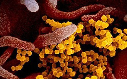Nga phát triển thiết bị phát hiện virus SARS-CoV-2 trong không khí