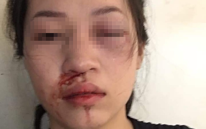 CSGT Tuyên Quang lên tiếng sau khi bị tố dùng gậy vụt vào mặt người phụ nữ vì không chấp hành hiệu lệnh dừng xe