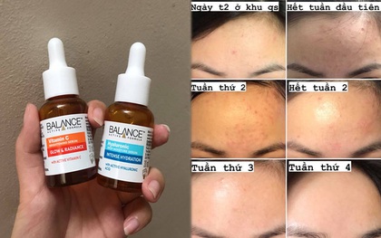 Nổi mụn ẩn sần khắp trán, nàng sinh viên vẫn trị khỏi thành công nhờ toàn đồ skincare giá rẻ