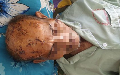 Nghi án giành đất, con rạch nát đầu cha già bệnh tật