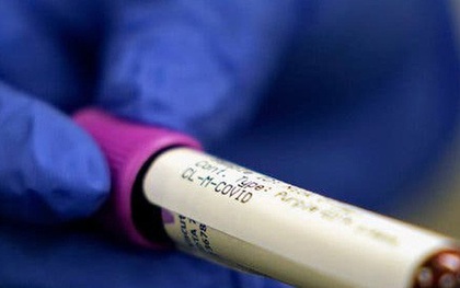 Thị trường thiết bị xét nghiệm kháng thể tại Mỹ: Sự vô lương tâm lên ngôi trong mùa COVID-19?