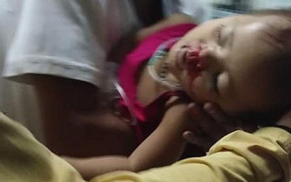 Hy hữu chuyện cháu bé 2 tuổi ở Quảng Nam gặp nạn "trên trời rơi xuống"