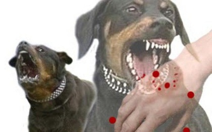 Nghệ An: Chó phát bệnh dại cắn liên tiếp 2 cháu nhỏ