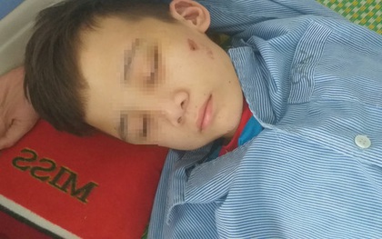 Vụ bé trai 14 tuổi bị chủ quán bánh xèo ở Bắc Ninh "tra tấn": Nhà trường sẵn sàng cho cháu trở lại học