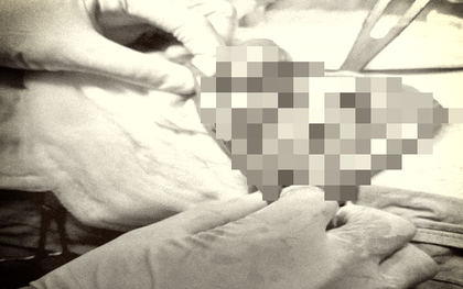 Tài xế xe tải suýt bị… bẹp dúm do đồng nghiệp bất cẩn khi lùi xe