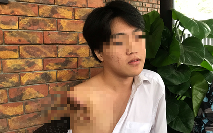 Nam sinh 16 tuổi bị máy tiện cuốn đứt lìa cánh tay trong giờ học thực hành