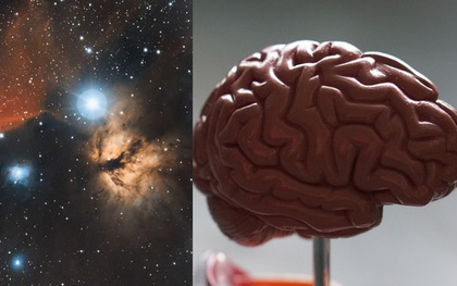 Các nhà khoa học kinh ngạc khi phát hiện sự tương đồng kỳ lạ giữa não người và vũ trụ
