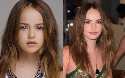 "Bé gái đẹp nhất thế giới" từng gây sốt với diện mạo ngọt ngào hệt như thiên thần giờ sở hữu nhan sắc ra sao khi bước sang tuổi 15?