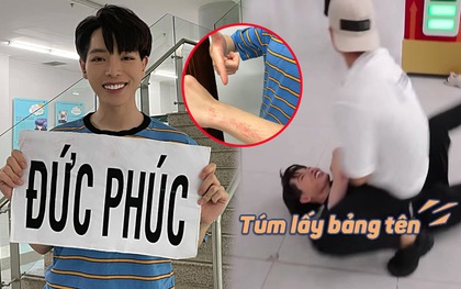 Đức Phúc thương tích đầy mình hậu Running Man: Tay rướm máu, mặt trầy xước vì trận xé bảng tên