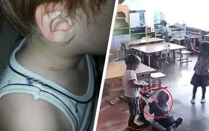 Mẹ đón con từ trường về với vết thâm tím trên cổ, bủn rủn tay chân khi xem lại camera nhưng giận run người với câu trả lời của giáo viên