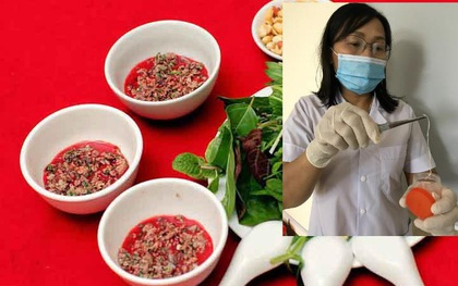 Thích ăn tiết canh, 1 nam giới "lôi" được giun dài từ đùi