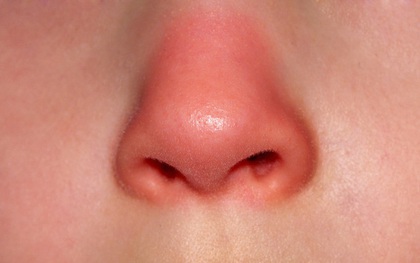 Mũi là "đèn tín hiệu" của phổi: Nếu mũi xuất hiện 3 dấu hiệu lạ thì bạn nên đi kiểm tra phổi ngay