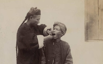 Bộ ảnh phản ánh xã hội cuối thời nhà Thanh: Nhìn nha sĩ dùng dụng cụ thô sơ nhổ răng cho bệnh nhân mà ngỡ ngàng