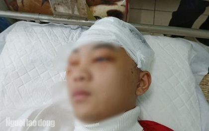 Khởi tố, bắt giam nam sinh lớp 11 đánh bạn học vỡ sọ não