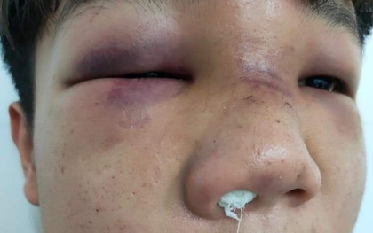 Thái Nguyên: Học sinh mâu thuẫn, phụ huynh hành hung bạn của con