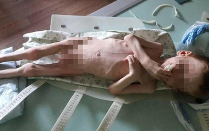Bé trai 4 tuổi nặng 7kg chỉ có da bọc xương, bố đổ lỗi cho thí nghiệm tàn ác của bác sĩ nhưng 1 năm sau sự thật khủng khiếp bị phơi bày