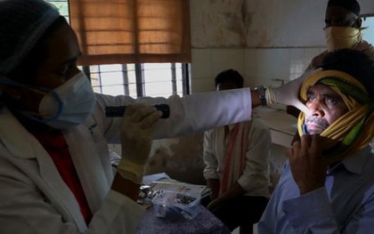 Bệnh nấm đen gia tăng mạnh ở những bệnh nhân Covid-19 đã hồi phục tại Ấn Độ