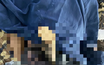 Té lúc cưa cây thuê, người đàn ông nghèo bị cọc bần đâm thấu hạ vị