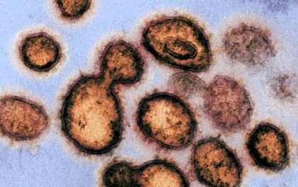 Phát hiện các virus cổ đại bị "đóng băng" 14.400 năm chưa từng được biết đến