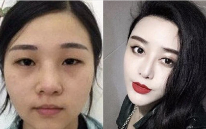 Kế hoạch "nghịch thiên đổi vận" của hot girl dao kéo: Chi 28 tỉ đồng để giống Phạm Băng Băng nhưng hôn nhân ê chề khi lấy nhầm chồng đồng tính
