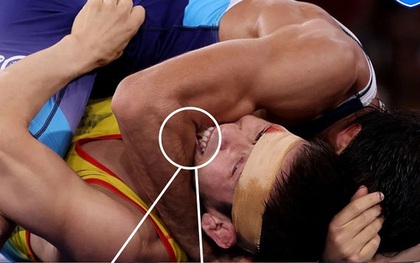 Khoảnh khắc xấu xí nhất Olympic: Đô vật cắn người, dấu răng hằn trên tay đối thủ nhưng "luật hoa quả" không chừa một ai