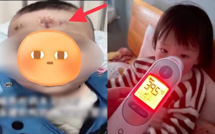 Bé gái 10 tháng tuổi xuất hiện dấu hiệu lạ trên trán, mẹ hốt hoảng đưa con đến bệnh viện rồi ngã ngửa vì cách chữa bệnh "theo kiểu bà ngoại"