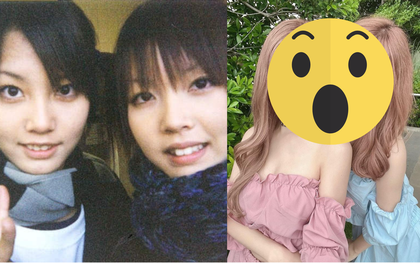 Từng phẫu thuật thẩm mỹ để “không ai đẹp hơn”, cặp  sinh đôi nổi tiếng người Nhật bây giờ ra sao?