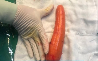 Đưa củ cà rốt dài 20 cm vào "chỗ kín", thiếu niên phải nhập viện