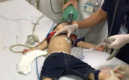 Bé trai 22 tháng tuổi ngưng tim, ngưng thở vì hóc thạch rau câu