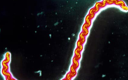 Ghi nhận 2 trường hợp nhiễm xoắn khuẩn vàng da tại Bà Rịa - Vũng Tàu