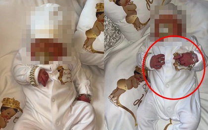 Em bé "vương giả" mới chào đời đã đeo vàng đầy người, dân mạng chẳng khen đẹp mà chỉ thấy nguy hiểm vì một chi tiết