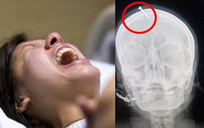 Thai phụ mang bầu bé gái, thầy lang "dỏm" hứa chuyển giới thai nhi trong bụng thành trai bằng biện pháp không tưởng, ảnh chụp X-quang gây sốc
