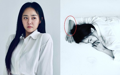 "Em gái quốc dân" Moon Geun Young lộ diện sau 4 cuộc phẫu thuật, xót xa vết thương kéo dài cả nửa cánh tay