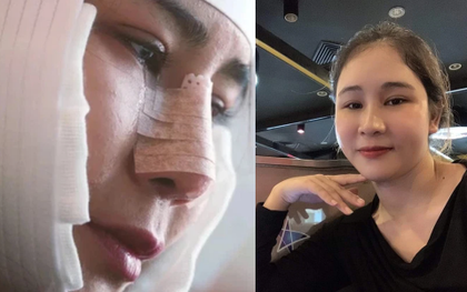 Bị chế nhạo là người khỉ, cô gái cắn răng chịu đau, trải qua 5 cuộc đại phẫu mong đổi đời