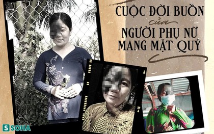 Cuộc đời buồn của "người mẹ mặt quỷ" và món quà vô giá trời ban