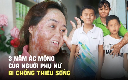 Người phụ nữ bị chồng tưới xăng thiêu sống, bỏng 92%: "3 năm qua giống như một cơn ác mộng, em đau lắm nhưng phải sống vì con"