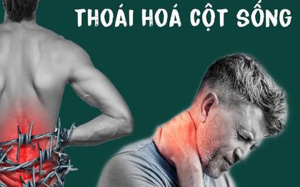 3 thói quen thường gặp là "vua bào mòn" cột sống: Bác sĩ cảnh báo đau âm ỉ kéo dài ở 2 vùng này thì phải khám ngay kẻo muộn