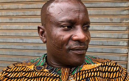 Tập tục rạch mặt tại Nigeria: Khi những vết sẹo trên mặt xác định danh tính và vẻ đẹp của một người