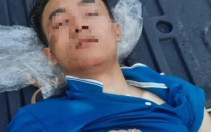 Nam thanh niên được phát hiện trong tình trạng dập não ở nghĩa trang