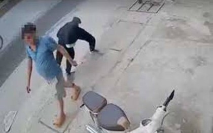 Vụ chém đứt lìa chân người đàn ông ở Hà Nội: Hành vi dã man nhưng chưa thuộc tội giết người?