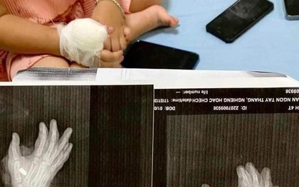 Thanh Hoá: Nổ súng tại quán karaoke, một cháu bé 4 tuổi bị đạn găm vào tay