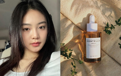 5 chai serum trị mụn giá chưa đến 500.000 VNĐ: Hàng bình dân nhưng chất lượng khiến nhiều chị em hài lòng