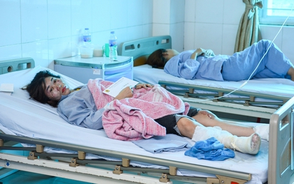 Lời kể của nạn nhân vụ nổ kinh hoàng khiến 34 người bị thương ở Bắc Ninh