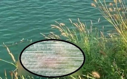Phát hiện cánh tay người móc vào lưỡi câu ở Bình Dương