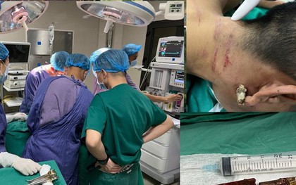 Phú Thọ: Cứu sống nam thanh niên bị thanh tre đâm xuyên cổ