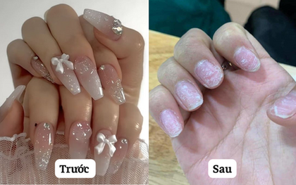 Tình trạng chung của chị em sau Tết: Làm nail hết mình, tháo nail hết hồn