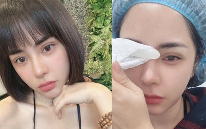 Bạn gái hơn 6 tuổi của Huỳnh Anh công khai tiếp tục thẩm mỹ