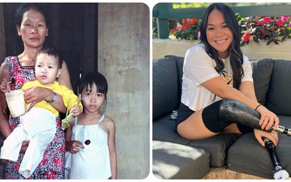 Cuộc sống hiện tại của bé gái gốc Việt bị bố mẹ nổ bom mất 2 chân: Được báo chí thế giới gọi là "nữ kình ngư thần kỳ", trở thành đại sứ truyền cảm hứng cho những người khuyết tật