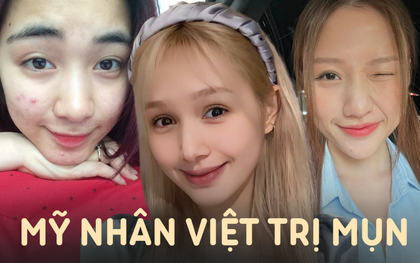 Mỹ nhân Vbiz từng "khốn khổ" vì mặt mụn, giờ lấy lại phong độ đỉnh cao nhờ "đúng thầy đúng thuốc"